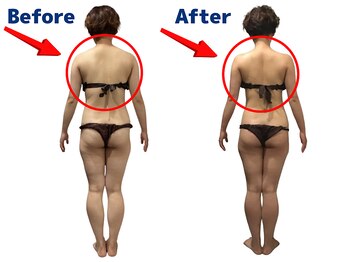 ワクワクボディクリニック 二俣川店(WAKUWAKU BODY CLINIC)/肩甲骨がクッキリしました!