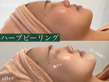 モア 多治見店(MORE)/お客様ビフォーアフター♪