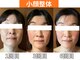 マロカ(Marroka)の写真