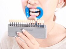 ホワイトニングバー 新潟店/ケア前の歯のお色をチェック！