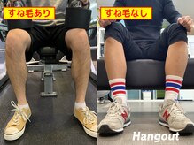ハングアウト(HANGOUT)/【久留米メンズ脱毛】脚脱毛