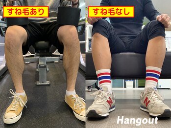 ハングアウト(HANGOUT)/【久留米メンズ脱毛】脚脱毛