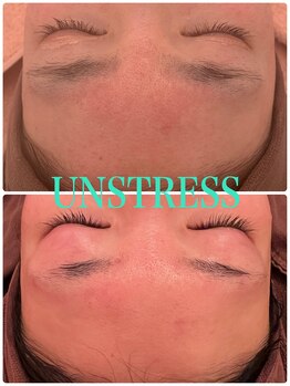 スイートルーム(Sweet Room)/田中みな実愛用エステ