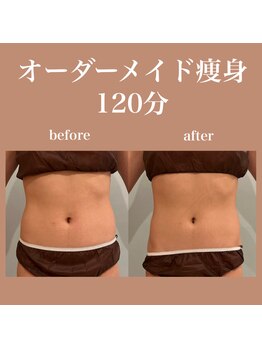 フラットベリー 恵比寿(Flat BELLY)/究極のお腹集中ケア120分コース