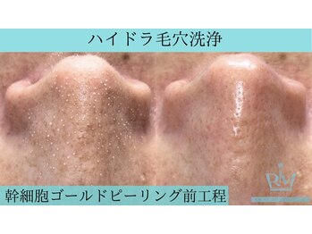 リメイククリニカルビューティー(Remake clinical beauty)/メンズの肌管理