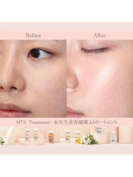 レプス(Lepus)/水光生美容液トリートメント