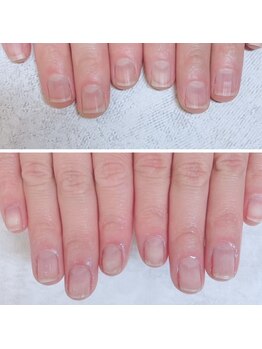 ラカ 長野駅前本店(LaKa)の写真/【深爪・薄い爪・爪でお悩みの方へ！】自爪で魅せる★自爪育成ケアで話題の【最強美爪ネイルケア！】