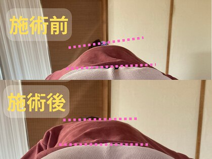 はり灸院あずの写真