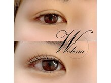 ウェリナ(welina)/
