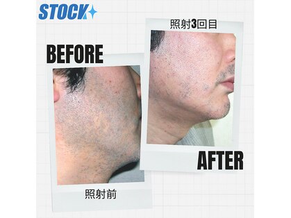 ストック 立花店(STOCK)の写真
