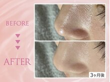 クリアラボ 池袋2nd(Clear Lab)/韓国肌管理&毛穴洗浄専門店