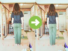 サプライズ整体院/20代ママの初回産後の骨盤矯正