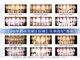 ホワイトニングショップ 長崎店の写真