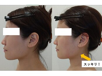 クレール アオヤマ(CLAIRE AOYAMA)/顔面やせコルギ&頭蓋骨小顔矯正