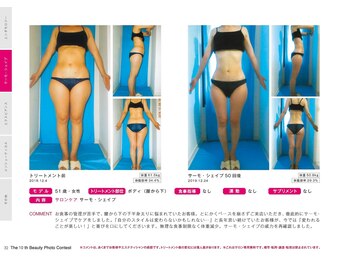 Nビューティー/最新エンダモロジーBODY