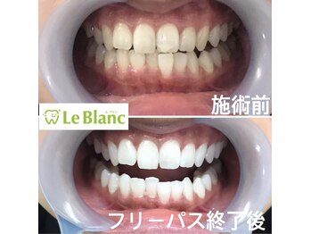 ルブラン 奈良店(Le Blanc)/一番リーズナブルなコース!!