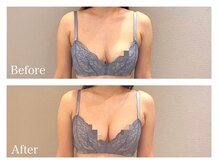 ククナ(KUKUNA)/*バストアップマッサージ*