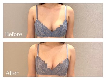 ククナ(KUKUNA)/*バストアップマッサージ*