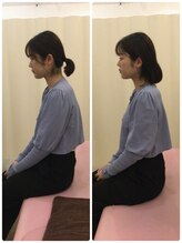 福岡西新整骨院/ビフォーアフター