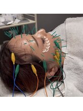 ハリステ 紀三井寺店(HARISTE)/＊美容鍼フルフェイス＊