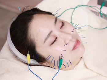 ミエリア美容鍼灸院(mielia美容鍼灸院)の写真/更年期やイライラ、不眠、肩こり、腰痛などでお悩みの女性へ。女性専用の鍼灸院ミエリアにお任せを。