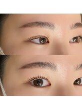 トゥモローズ(TOMOROWS)/ハリウッドブロウリフト