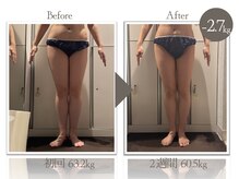 ビューティーリバース 本厚木店/★劇的ビフォーアフター★