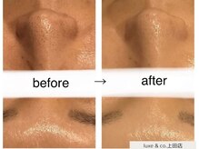 リュクスアンドコー 上田店(Luxe&co.)の雰囲気（【素肌が変わる！肌悩み卒業☆】）