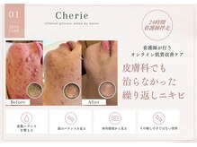 シェリー(Cherie)の雰囲気（皮膚科で改善しなかった慢性皮膚炎、ニキビ改善【ニキビ/広島】）