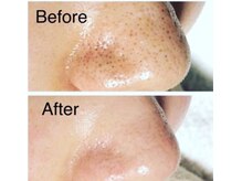 カラー(Calla)/AQUA SURE H2