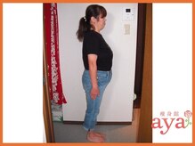 痩身館アヤ(aya)/耳つぼダイエット【富山/痩身】