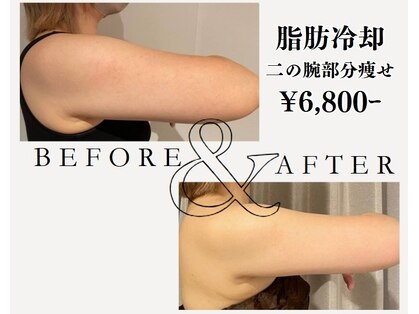 ビシル(Bishiru.)の写真