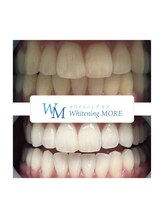 ホワイトニング モア(Whitening MORE)/ビフォーアフター