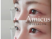 アミークス(Amicus)