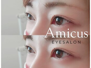 アミークス(Amicus)