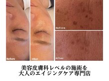 アールヨンマルハチ フェイスアンドアイ(R408.face&eye)