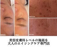 アールヨンマルハチ フェイスアンドアイ(R408.face&eye)