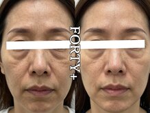 フォーティープラス(FORTY+)/施術事例