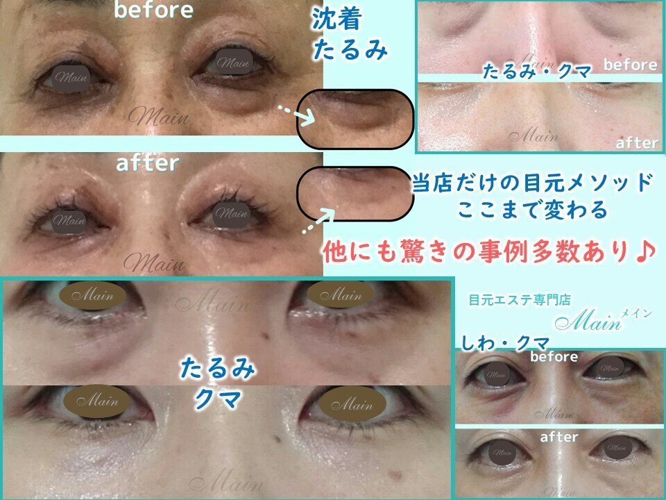 メイン(Main)｜ホットペッパービューティー