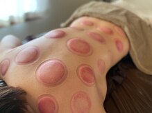 ベル(Belle)/カッピング