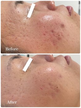 サラシック(salachic)/