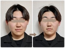 哲心 姫路/すぐに変化を体感できました☆