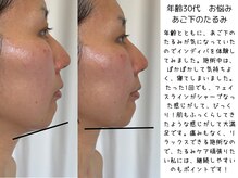 パルテール/たった1回でこの変化【口コミ】