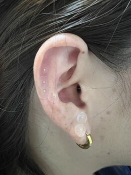 ファイン(fine)/耳つぼジュエリー