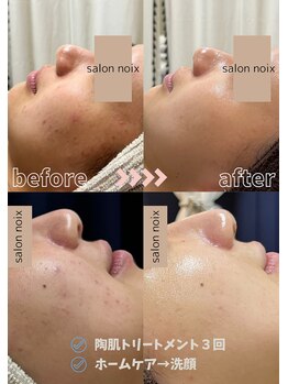 サロンノワ(salon noix)/《3か月で別人級》