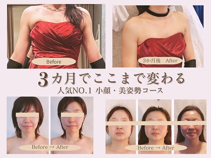 フォーリーフ(4 Leaf)の写真