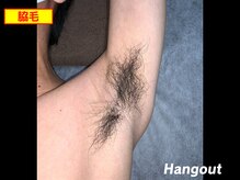 ハングアウト(HANGOUT)/【久留米メンズ脱毛】脇脱毛前