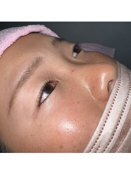 ビューティフェイス ビューティアイラッシュ 岡山天満屋店(BeautyFace Beautyeyelash)/まつげパーマデザイン【岡山】