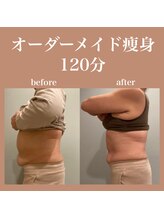 フラットベリー 恵比寿(Flat BELLY)/究極のお腹集中ケア120分コース