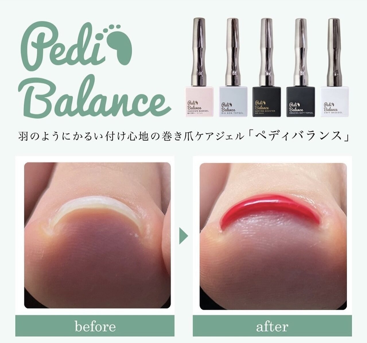 Pedi Balance（ペディバランス）ベース、トップ、レッドネイビー巻き爪